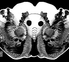 Brilliant Bones by limerick