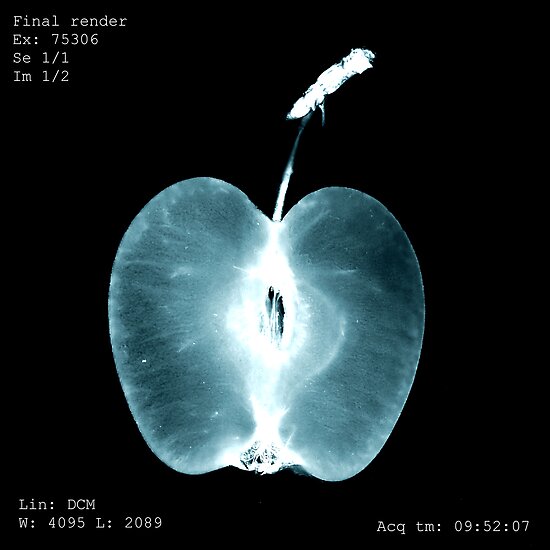 "Apple Xray" Posters by Alina Uritskaya Redbubble