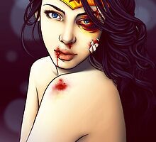 You Should See the Other Guy by Alivia Marie