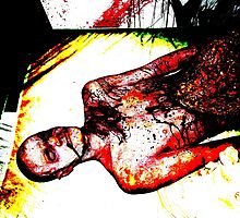 Flesh Eating Virus by Hallowaltz