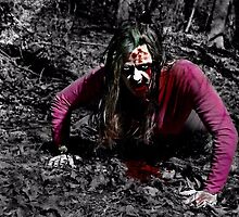 ZOMBIE ATTACK by Scott Mitchell