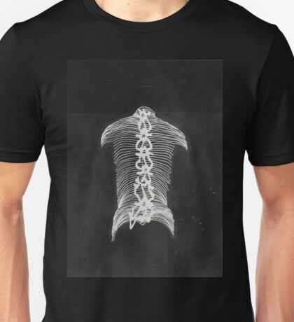 got scoliosis shirt