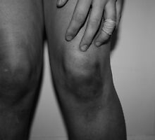 wounded by Heather Chipps