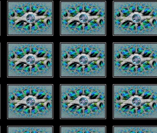 lyme and connective tissue disorder