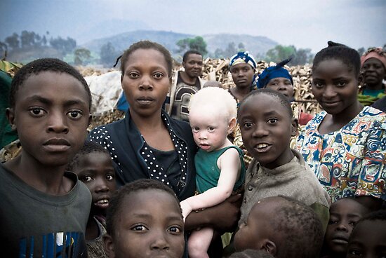 Street Photography: Albino by Bryn Street Photography: Albino by Bryn