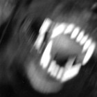 AlphaCvnt