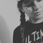 liv-mcc