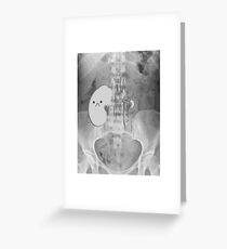 Kidney Transplant Donor Greeting Card