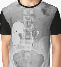 Kidney Transplant Donor Graphic T-Shirt