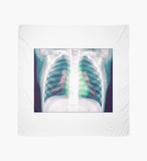 Chest x-ray of a 3 year old female baby Scarf