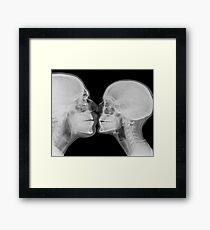 Kissing Couple. Two people kissing under x-ray Framed Print