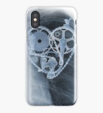 BiKE LOVE X Ray bicycle heart components iPhone Case