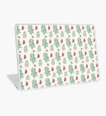 Watermelon Stevens Laptop Skin