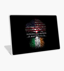 Amerikanisch mit irischen Wurzeln angebaut Laptop Skin