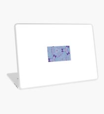 bleh Laptop Skin