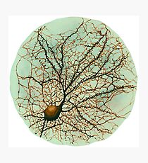 Dendritic tree and spines of an hippocampal neuron - watercolor - green Photographic Print