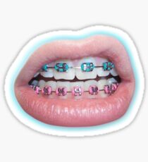 Cotton Candy Braces Sticker