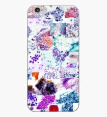 Psychedelic Cytology iPhone Case