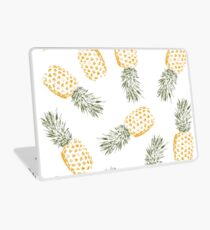 Ananas Laptop Skin