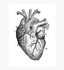 Anatomical Heart Photographic Print