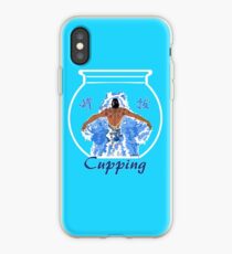 Schröpfen (Traditionelle Chinesische Medizin) iPhone-Hülle & Cover