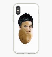 Noel Gallagher Oasis Potato iPhone Case