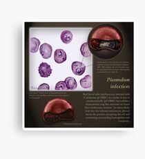 Plasmodium falciparum Canvas Print