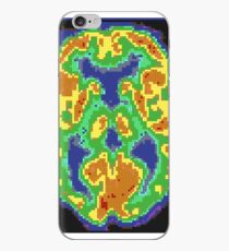 Minecraft Brain iPhone Case