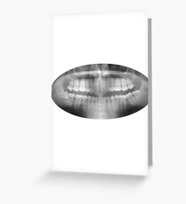Crooked Tooth Greeting Card