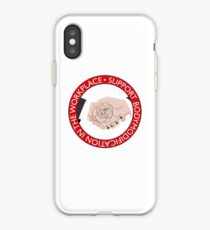 Support Body Modification iPhone Case