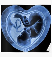 Watercolor fetus inside the heart shaped womb Poster