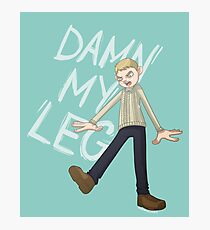 DAMN MY LEG Photographic Print