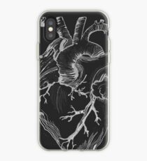Black-out Anatomical heart iPhone Case