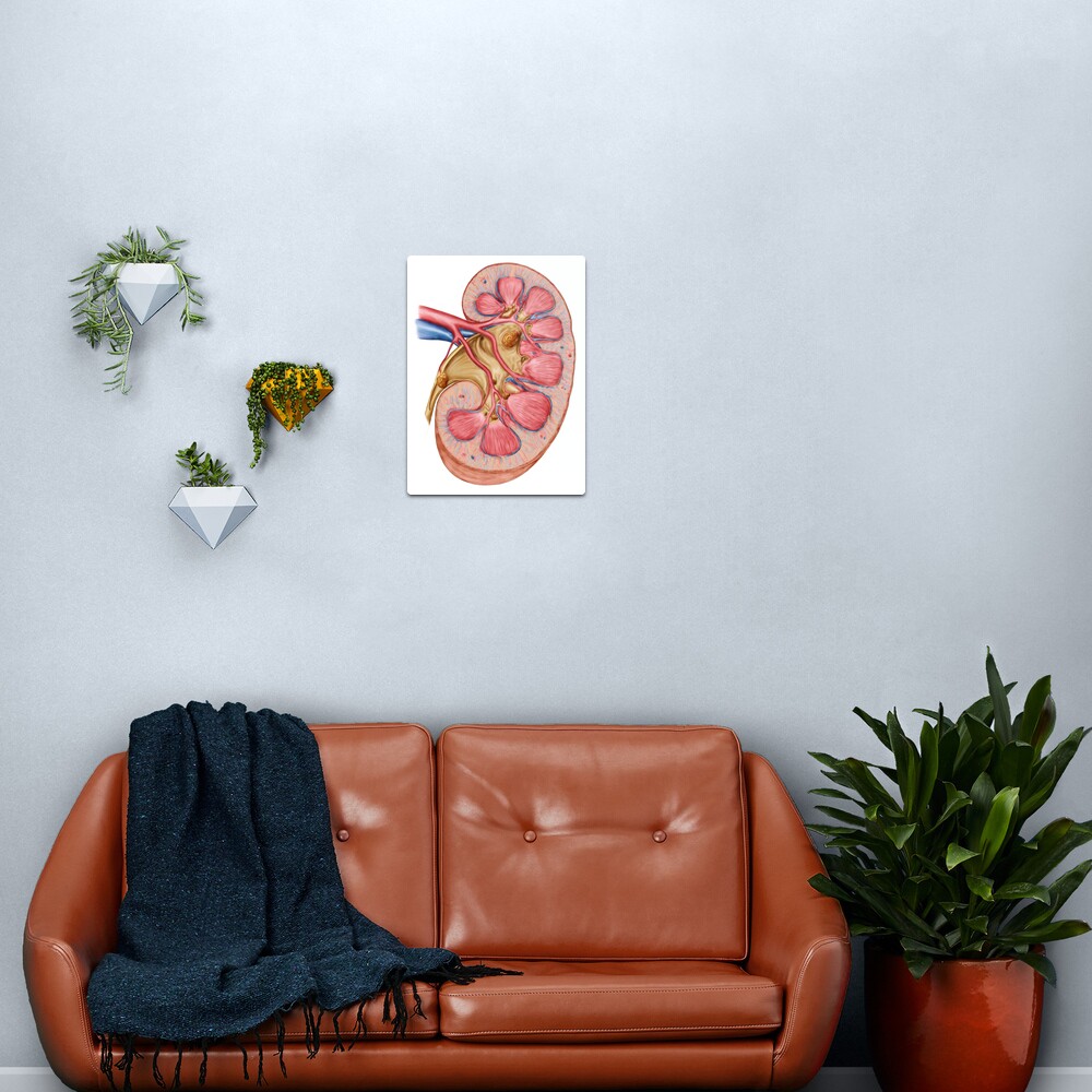 calculus of kidney