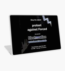 Stop shock Laptop Skin