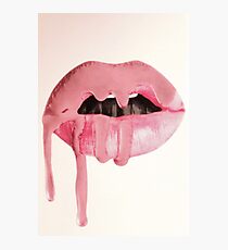 Kylie Jenner Lippenästhetik Fotodruck