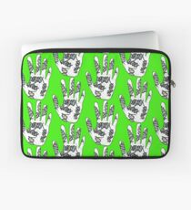 Double Helix Hand Laptop Sleeve