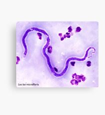 Loa loa microfilaria Canvas Print