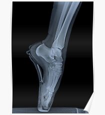 x-ray of a ballet dancer standing on pointe Poster