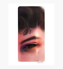Freckles Photographic Print