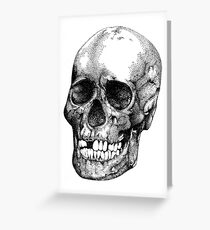 Skull Greeting Card