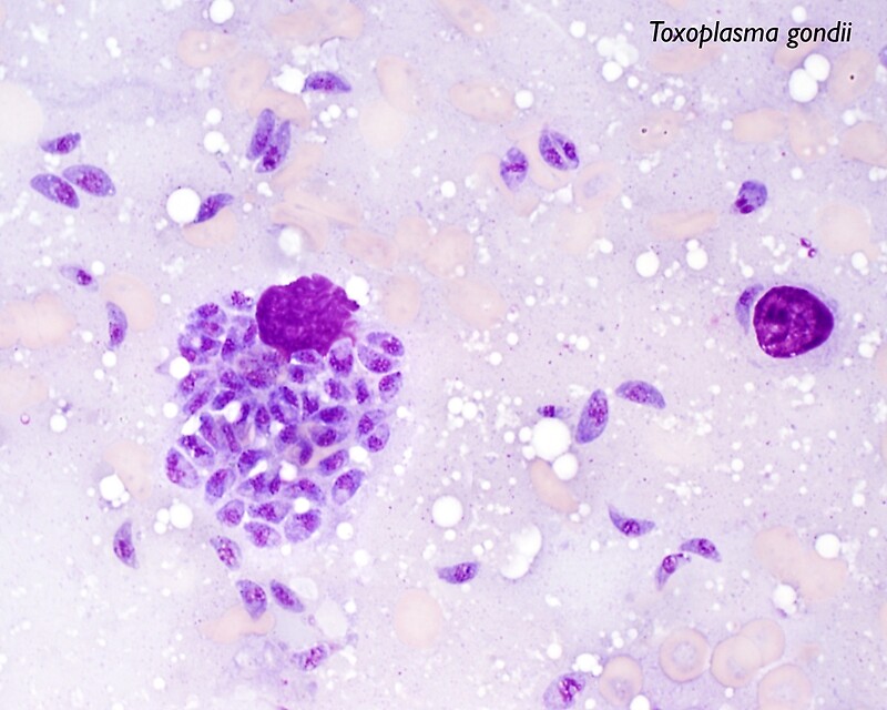 Toxoplasma gondii. Токсоплазма gondii. Токсоплазма гондии трофозоит. Токсоплазма эндозоиты. Трофозоиты Toxoplasma gondii.