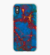 Großstruktur - Design 2 iPhone-Hülle & Cover