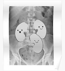 Kidney Transplant Recipient Poster