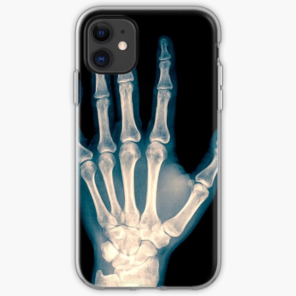 Oddities: X-Ray iphone 11 case Oddities: X-Ray iphone 11 case