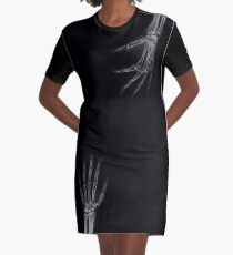 Gotcha! Graphic T-Shirt Dress