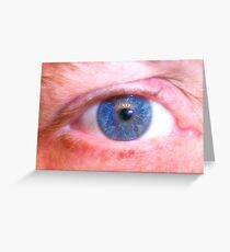 Eye Greeting Card