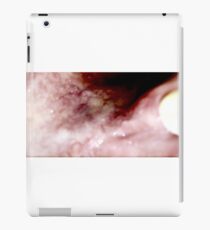 Guts iPad Case/Skin