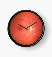 Retina Clock