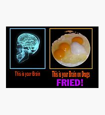 Brain Photographic Print